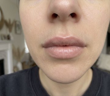 Client photo